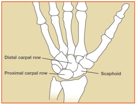 Scaphoid fracture - John Erickson, MD