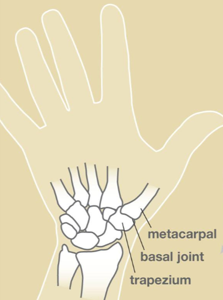 thumb CMC pain