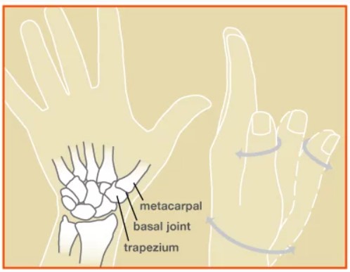 nonsurgical thumb arthritis treatment
