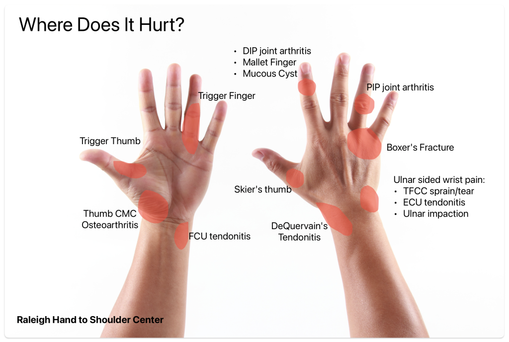 hand and wrist symptoms