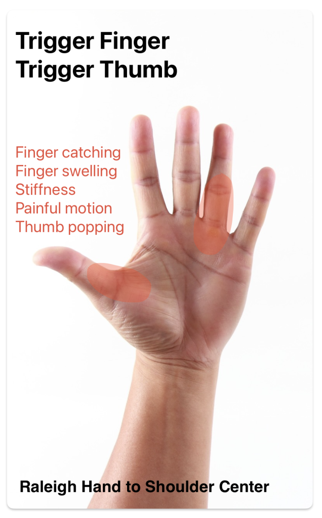 trigger finger symptoms